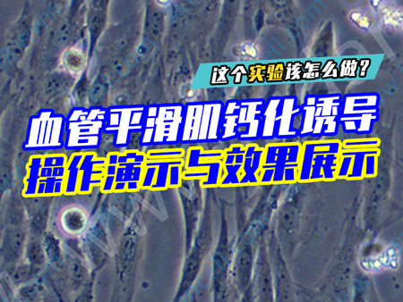 血管平滑肌细胞钙化诱导操作演示与效果展示