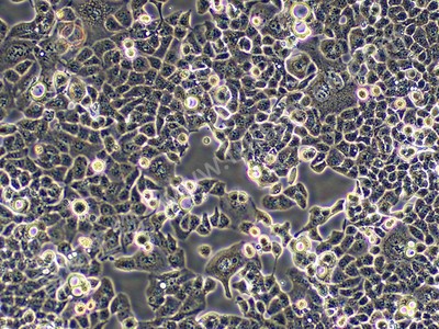 人子宫内膜癌细胞；HEC-1-B (STR) - 上海富衡生物科技有限公司